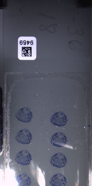 Media type: image; Special Collections 3102   shows specimen_part histological serial section;  Description: Whole slide scan, SC-3102, slide 18;